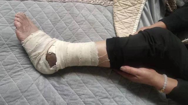 2025新奥资料正版大全和女子遭毒蛇咬伤身亡与女子遭毒蛇咬伤身亡视频