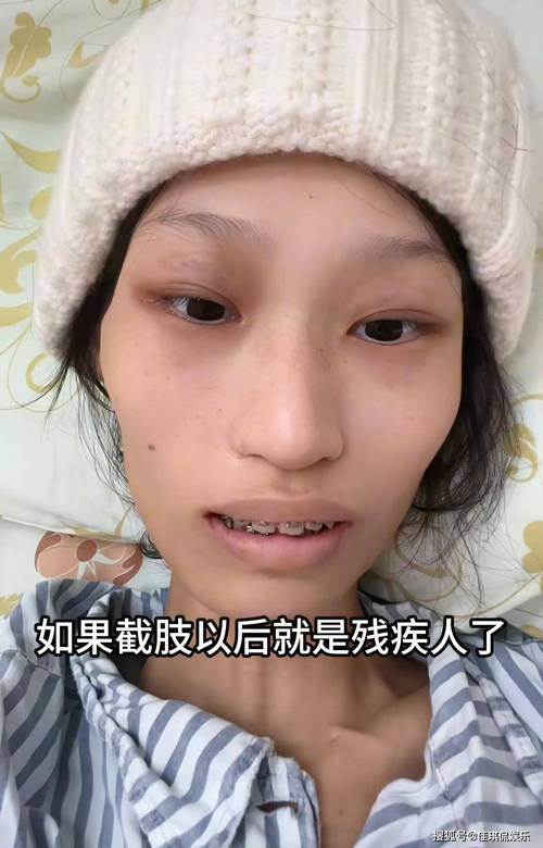 澳门研究生资料公开,和抗癌2年后发现误诊与抗癌2年后发现误诊怎么办